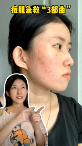 SSUI国庆日优惠活动还在持续热卖中🔥🔥 1️⃣9️⃣个优惠配套 任你挑选和购买😍😍 🎁👉 mini洗脸霜 30ml 🎁👉 mini gel精华 10ml ✅ 任购一套即可 ➕ RM68 直接带走【小圆瓶修复霜】