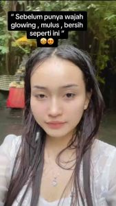 [BONUS CLUTH KOSMETIK]PAKET ACNE GLOWING ORLIN BEAUTY SKINCARE PENGHILANG JERAWAT ORLIN PAKET BEBAS JERAWAT  KRIM BPOM SKINCARE JERAWAT ORLIN BPOM KRIM JERAWAT PAKET SKINCARE WAJAH SENSITIF SKINCARE JERAWAT BEKAS  SKINCARE JERAWAT BATU ORIN SKINCARE VIRAL