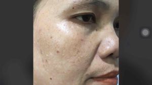 Kem dưỡng ban ngày trắng hồng mờ nám thâm OBsal Flower Blossoming Snow Face Day Cream 20ml ( OBSAL ) Kem Dưỡng Da Cho Da Nhạy Cảm Kem Dưỡng Làm Trắng Da Từ Bên Trong - Lazada