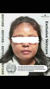 Bundling Toner Exclusive & Day Cream Exclusive 2 IN 1 Benings Indonesia BPOM