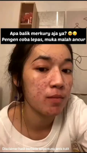 50 gram murah lebay!!!!PAKET 3 PCS 50 gram kiyoko phyllia beauty soap untuk jerawat&flek  memutihkan&menyehatkan kulit