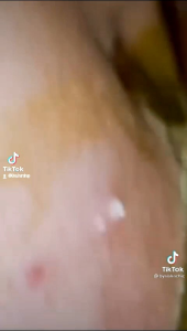 Masker Komedo BPOM Garansi Uang Kembali Jika Palsu