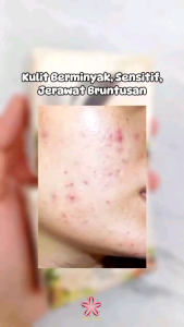 SABUN BERAS HERBAL SR12 TERLARIS..!! RICE SOAP / SABUN JERAWAT