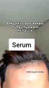 [ COD ] Minyak Penumbuh Rambut Rontok Clothes Of Skin 7 Day Perawatan Dan Penumbuh Rambut Rontok Dalam 7 Hari