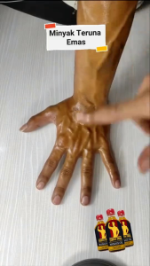 MYK URUT M.T.E Terjamin Berkesan