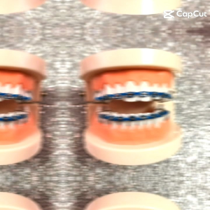 Le lชn สวมใส่ง่ายใช้งานสะดวก หลากหลายสี อะไหล่กิ๊ฟติดผม