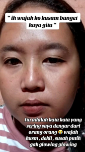 FACIAL WASH BRIGHTENING: Sabun Pembersih Wajah Membantu Mencerahkan & Mengecilkan Pori