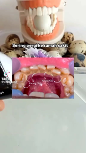 Pasta Gigi Charcoal SR12 - Odol Pemutih Gigi - Pasta Gigi Herbal Memutihkan Gigi dan Membersihkan Karang Gigi