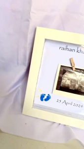 2020012 Pigura / frame 3d USG Baby Photo Frame