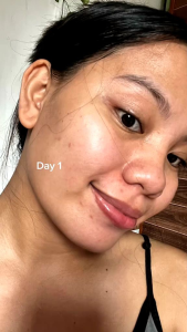 SKINMAGICAL REJUVENATING SET 3 for WhiteningPimpleMarks RemovalGlass SkinEffect