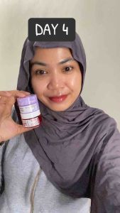 ADLEEVA - Revive Calming Moist Gel - Bantu menenangkan kulit berjerawat Dermatitis Breakout Purging Serta Meredakan Kemerahan