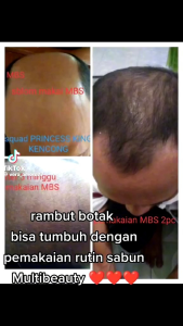 FREE ONGKIR DAN JARING SABUN MBS 1 PCS BATANG FREE JARING ORIGINAL KEMASAN BARU