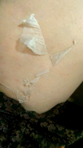 SCD Peeling Skin Lotion
