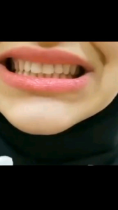 Gigi Palsu Atas Bawah Instant Gigi Palsu Silikon Alami Siap Pakai Bisa Untuk Penutup Ompong Snap On Smile Putih 100 %