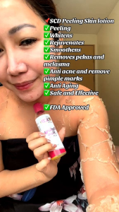 SCD Peeling Lotion Large (100ml) w/ FREEBIES (New Packaging 2025)