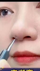 Satu Set facial Care alat Pembersih Komedo dan Jerawat isi 4 Dengan Storage Box