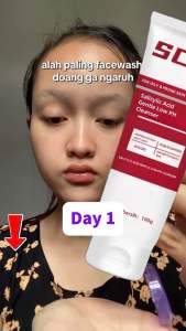 BPOM SC-11 Sabun Muka Facial Wash Pembersih Wajah  Wash Skin and Cleaning