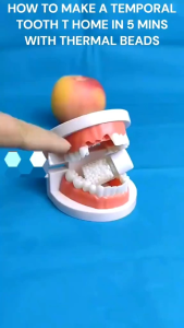 temporary tooth Fairytooth PENAMBAL GIGI isi 130BUTIR (PATAHLEPASRENGGANG) gigi palsu