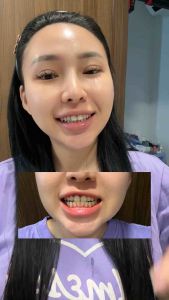 Serum Trắng Răng Unismile Hỗ Trợ Cải Thiện Vết Ố Vàng Unikare Dung Tích 10ml - LEPEAU