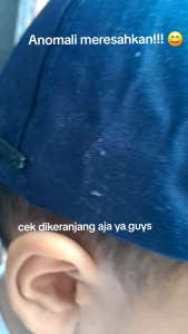 TOPI ANAK ANOMALI KARAKTER TUNGTUNGSAHUR FREE NAMA