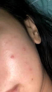 Skincare Alami Afourskin: Perawatan Kulit Sehari-hari yang Efektif