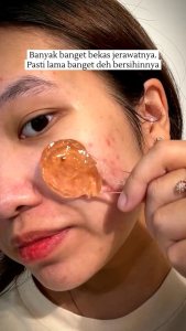 [FREE GIFT PROMO] EILEEN GRACE MOISTURIZE ROSE JELLY MASK AND DEEP CLEANSING BLACK JELLY MASK 300ML BPOM ORIGINAL