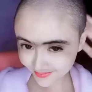 Serum Rambut Kebotakan: Solusi Perawatan Rambut Rontok