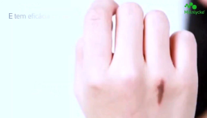 SCAR CARE DRESSING Mepiform Self-adherent dressing for scar management with Safetac® with long expiration