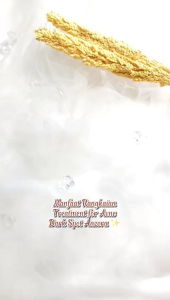 Skincare anzora acne dark spot ori BPOM - paket ads mengatasi flek hitam bekas jerawat - anzora skincare original haymay beaute