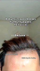 CLOTHES OF SKIN 7DAYS Ginger Serum Penumbuh Rambot Botak