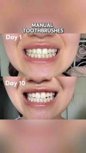 ToothCare+ Pro Series UltraSonic Electric Toothbrush (SATIN BLACK & ARCTIC WHITE) 90-Day Battery Life 50K VPM 5 Cleaning Modes + 3 Intensity Levels
