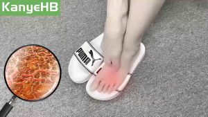 KanyeHB Foot Care Cream - Athletes Foot Odor - Foot Sweat & Itchy Feet - Net Wt 250g