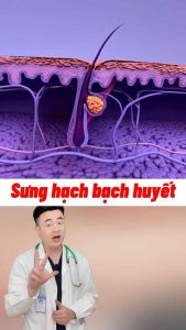 Kem Tan Hạch Bạch Huyết U Hạch Shixendo Cổ Truyền Nhật Bản - Mẫu mới