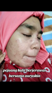 AURA SKINCARE ORIGINAL ISI 5 PCS oleh ELCY BEAUTY