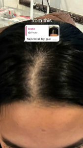 LASHBOSS Rosemary Hair Oil for Hair Growth Treatment Minyak Penumbuh Rambut Rosemary