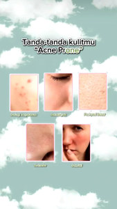 BG SKIN PAKET ACNE SENSITIF / CICA KEMASAN BARU FREE GIFT