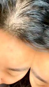 สบู่รากโสมดำ 5ก้อน100 ของแท้ บำรุงเส้นผม ลดร่วง แตกปลาย เพิ่มผมงอกใหม่ แชมพูสมุนไพร