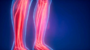 Apirex Bharata: Obat Hipertensi Darah Tinggi Ampuh BPOM