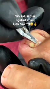 DIACOILNAILSERUM - PENGHILANG KUKU RUSAK CANTENGAN BERNANAH KUTIKULA PERAWATAN KUKU NAIL ART VITAMIN