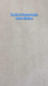 Emina Bright Stuff untuk Kulit Berjerawat