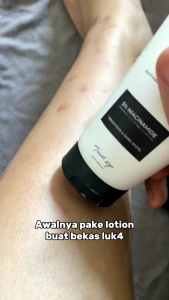 D'SAVIOR Combo Peeling: Solusi untuk Bekas Luka Kulit Sensitif