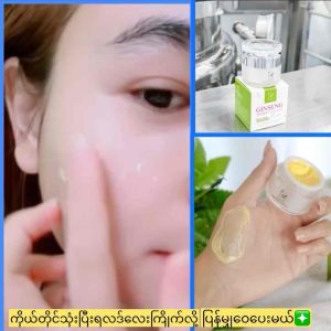 TheAuraဝက်ခြံအမဲစက်တင်းတိပ်ပျောက်Cream