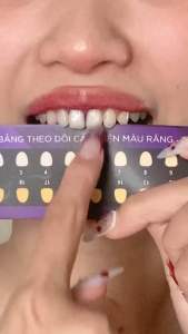 Serum Trắng Răng Unismile Hỗ Trợ Cải Thiện Vết Ố Vàng Nâng Tone Răng 10ml