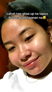 Transformed Skin Glow190 Rejuvenating Set with Niacinamide Arpha Arbutin