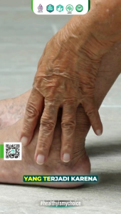 Uricid Pil asam urat Flu Tulang Rematik