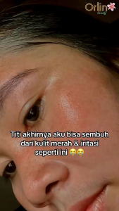 DAY CREAM ORLIN BRIGHTENING / CREAM SIANG ORLIN BEAUTY / GLOWING TANPA MAKEUP CEPAT MERESAP DI KULIT WAJAH/MENCERAHKAN