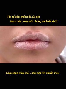 Tẩy tế bào chết môi sủi bọt chai Hồng