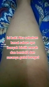 SABUN SUSU PEMUTIH SEREH