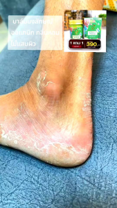 บาล์มนงลักษณ์ ออแกนิก {1แถม1} nongluk สมุนไพรกลิ่นหอมดอกกาสะลอง