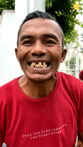 [FREE GIFT LIMITED] SOPAMI SP7 PASTA GIGI PEMUTIH PROBIOTIK 120g BPOM ORIGINAL